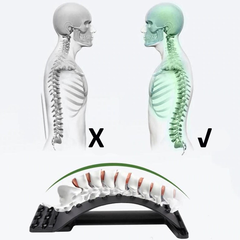 Product gallery 96648